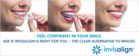 Invisalign® - Virtually Invisible Braces
